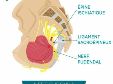 Nouvelle vidéo sur la NEVRALGIE PUDENDALE réalisée par le Dr Eric Bautrant