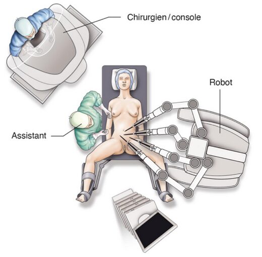 Coelioscopie robot assistée